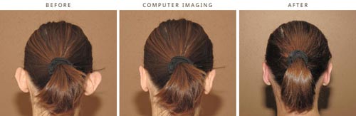 Computer Imaging